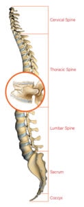 Vertebral Augmentation - Oregon Spinal Fracture Clinic